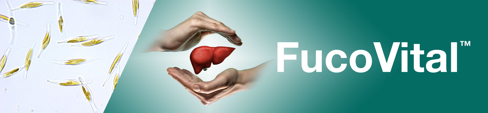 Fucovital can help manage nonalcholic fatty liver cells